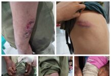 Tukang Ojek Dirampok dan Dianiaya dijalan Gumai Talang Sumsel, Kendaraan Motor Roda 2 Dibawa Kabur,Korban Mengalami Luka Serius